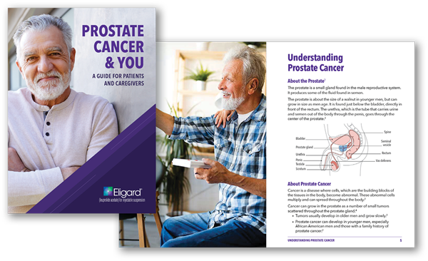 Prostate Cancer Guide
